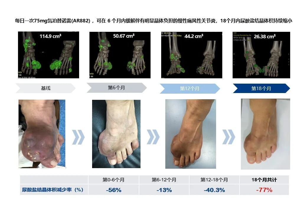 https://mmbiz.qpic.cn/sz_mmbiz_jpg/sFqAnGX0Tk0OueZiaAXkPGeBpOZe5zoyj8BzoWAkcQNLicujlOjp9GYlxgNnZWibFgticWnu3NIDTdutOWicAQcrpbQ/640?wx_fmt=jpeg&from=appmsg